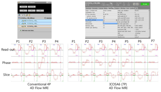 Phillips 스캐너 기반 ICOSA6 4D Flow MRI 개발. 프로토콜 메뉴에 ICOSA6 옵션을 추가하여 기존 4P 4D Flow MRI와 7P ICOSA6 4D Flow MRI를 선택 측정 가능함. MRI 측정 시뮬레이션에서 ICOSA6 방향의 유동 측정 gradient를 확인할 수 있음 (아래)