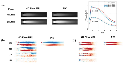 Particle image velocimetry (PIV)와 MRI를 이용한 속도 및 난류 측정 비교