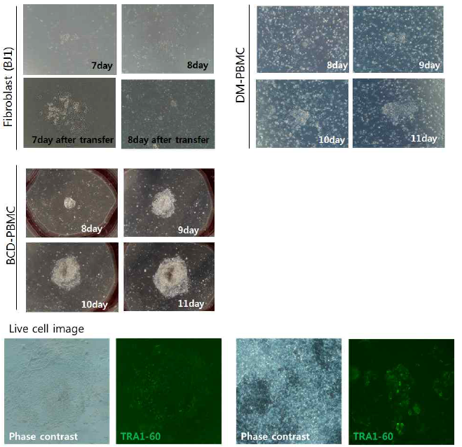 각 다른 체세포에 대한 sendai virus를 이용하여 역분화 초기 콜로니 형태와 RA1-60를 이용하여 역분화 초기 콜로니를 염색하여 live cell image 확인