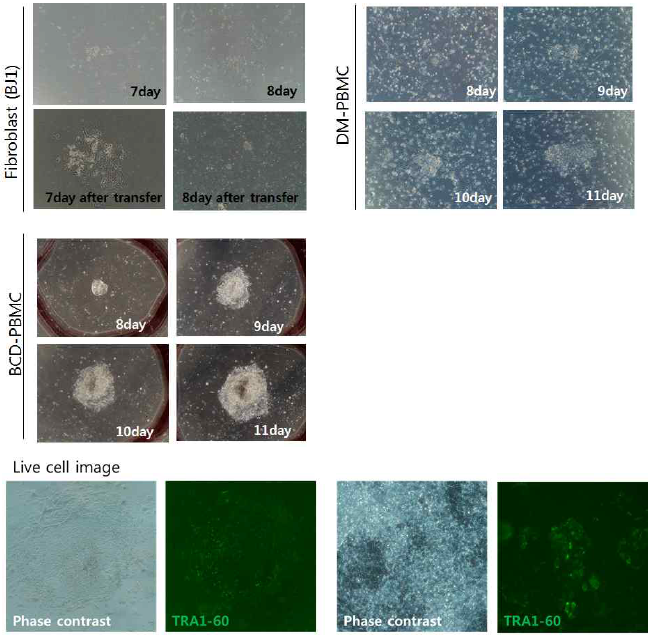 각 다른 체세포에 대한 sendai virus를 이용하여 역분화 초기 콜로니 형태와 RA1-60를 이용하여 역분화 초기 콜로니를 염색하여 live cell image 확인