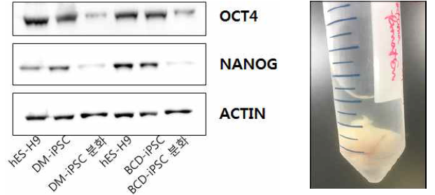 각 역분화 줄기세포에 대한 전분화능 특이 단백질 확인 (왼쪽-Western blot), CD-iPSC derived teratoma (오른쪽)