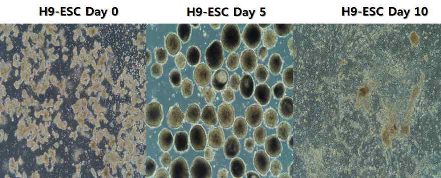 hESC-H9을 이용하여 자연분화 (EB)를 형성하여 분화 시기 별로 확인