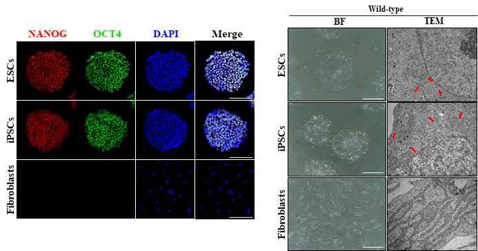 전분화능 줄기세포(hESC-H9, hiPSC-CMC3)와 체세포(MRC5)에 대한 면역 염색 사진과 세포소기관(소포체)의 형태학적 특징 확인. (TEM)