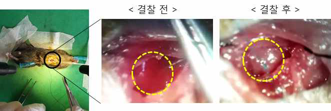 A murine model of myocardial infarction (MI) via left anterior descending (LAD) coronary artery ligation