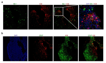 Co-localization of IBA-1 and GFAP-positive cells in Amyloid-β-positive area