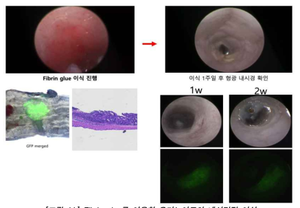 Fibrin glue를 이용한 오가노이드의 내시경적 이식