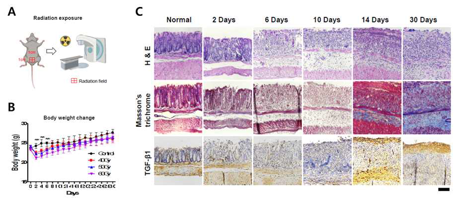 방사선 직장염 모델 제작. (A) 방사선 직장염 모델을 위한 방사선 조사 모식도 (B) 방사선 조사 후 모델의 체중 감소 확인 (C) 방사선 조사 부위의 구조적 손상 및 조직 염증 확인