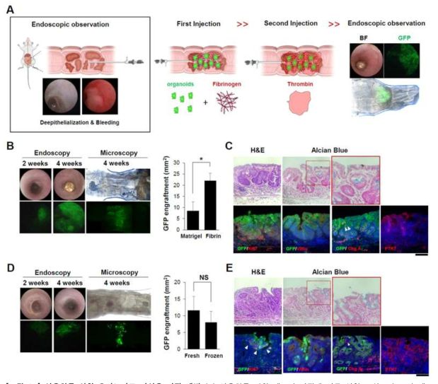 상용화를 위한 오가노이드 이식용 기질 개발 (A) 상용화를 위한 세포외 기질에 따른 실험 모식도 (B, C) 세포 외 기질에 따른 이식 효율 및 조직 분석 확인 (D, E) 냉동보존한 오가노이드의 이식효율을 확인