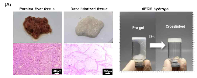 간 조직의 탈세포 과정을 통해 제작한 dECM hydrogel