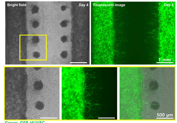 개발된 기술을 적용한 미세혈관 구조를 포함한 스페로이드 패터닝 결과