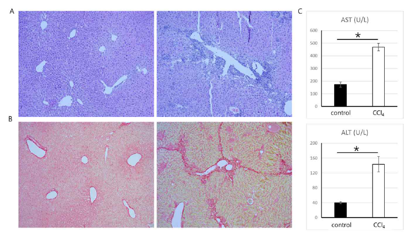 사염화탄소 유래 간섬유화 모델 제작 및 분석. A.간조직의 H 우, 사염화탄소 유래 간섬유화 모델 마우스), B.간조직의 Sirius Red 염색 (좌, control mice; 우, 사염화탄소 유래 간섬유화 모델 마우스), C, 혈청분석. 간 효소 아스파르트산 아미노전달효소(AST, Aspartate Aminotransferase)(상)와 알라닌 아미노전달효소(ALT, Alanine Aminotransferase)(하)