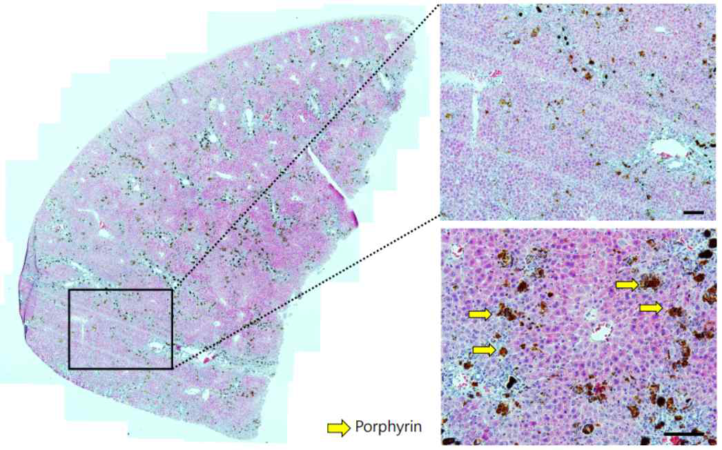 DDC 유래 간섬유화 모델 제작 및 분석. 마우스에 DDC를 장기간 투여하여 biliary fibrosis and cholestasis를 나타내는 만성 간 섬유화를 유도함