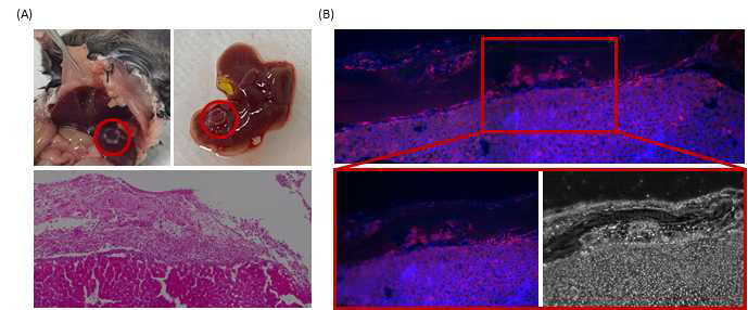 (A) (위) 제작된 구조체를 간 조직에 부착 (빨간색 원형) (아래) Histology 분석을 통한 구조체와 동물 간 조직 분석. (B) Albumin 염색을 통한 세포 기능 확인