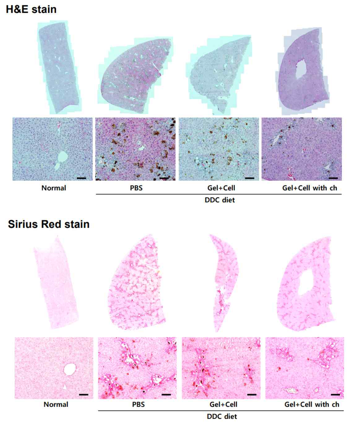 DDC 유도된 만성 간섬유화모델에 간조직모사체를 이식한 후, H&E staining과 Sirius Red staining을 이용한 간 조직 histology를 분석함. (Normal: 정상 간조직, PBS: 식염수 투여, Gel+Cell: 간조 직모사체, Gel+Cell (Ch): 미세유로가 있는 간조직모사체)