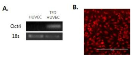 Oct4 발현 유무를 PCR과 immunocytochemistry로 확인