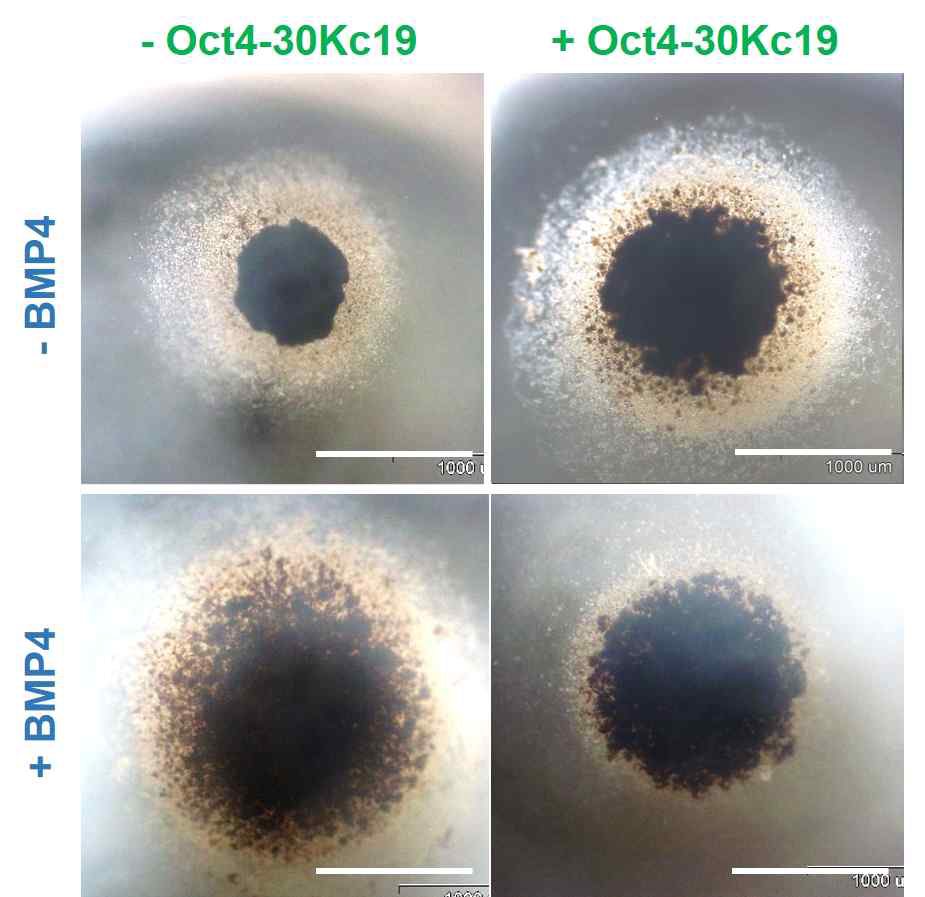 BMP4, Oct4-30Kc19 처리 유무에 따른 4가지 군을 3차원으로 응집한 세포의 모습