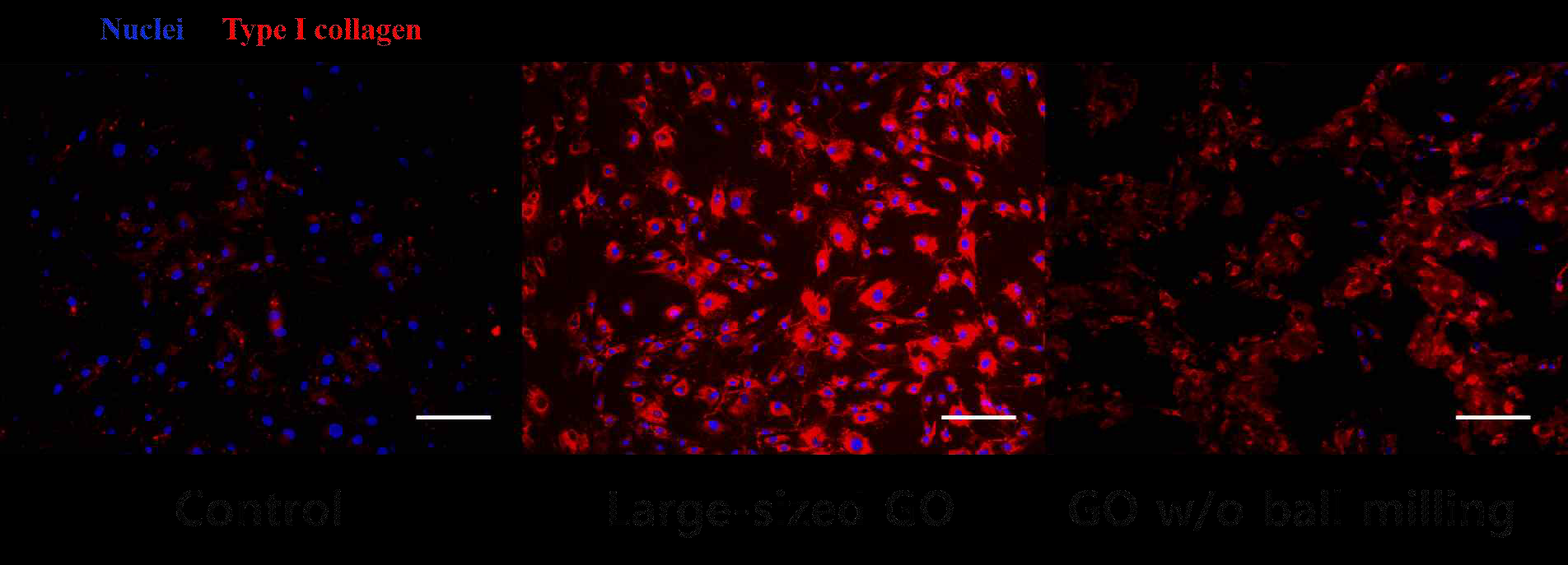 GO disk를 크기별로 처리한 뒤 collagen-type 1에 대한 immunocytochemistry 이미지 결과