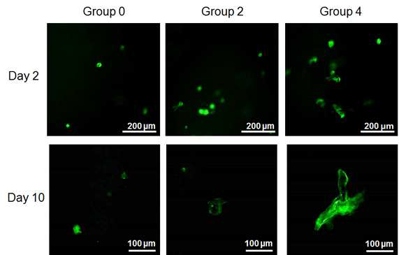성체 줄기세포를 scaffold에서 배양한 후 부착능 파악용 형광 이미지 (초록색 형광: F-actin 염색)