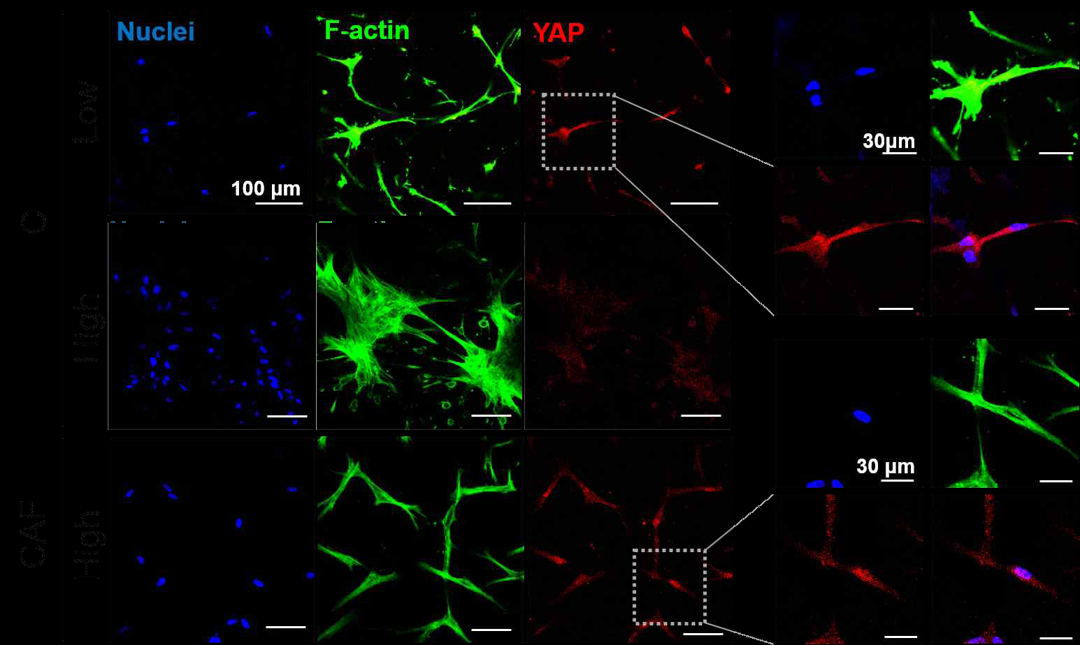 Collagen only gel과 window frame을 이용한 collagen-alginate gel의 F-actin 및 YAP localization 차이