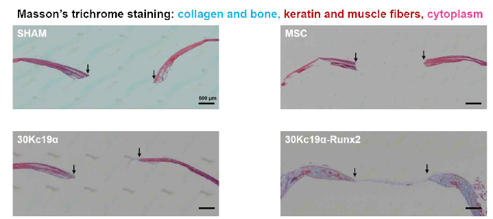 Masson’s trichrome staining을 통해 30Kc19α 기반 재조합 단백질의 골 재생 유도 확인