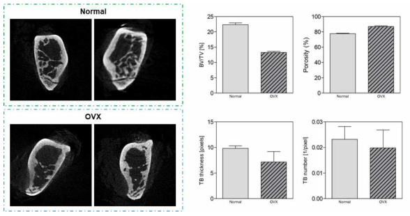 난소 적출 한 쥐와 적출하지 않은 control 군의 micro-CT 이미지와 분석 결과