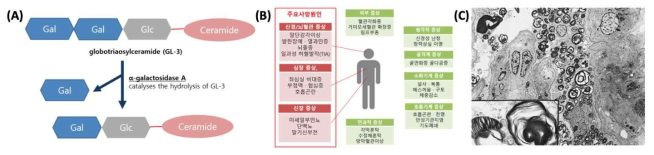 (A) α-galactosidase A(GLA)의 globotriaosylceramide (GL-3)분해와 관련된 대사 경로, (B) 파브리병의 전신적 증상 (C) 파브리병의 특징적인 소견인 층판소체(zebra body)가 신장에 침착된 전자현미경 검사 사진