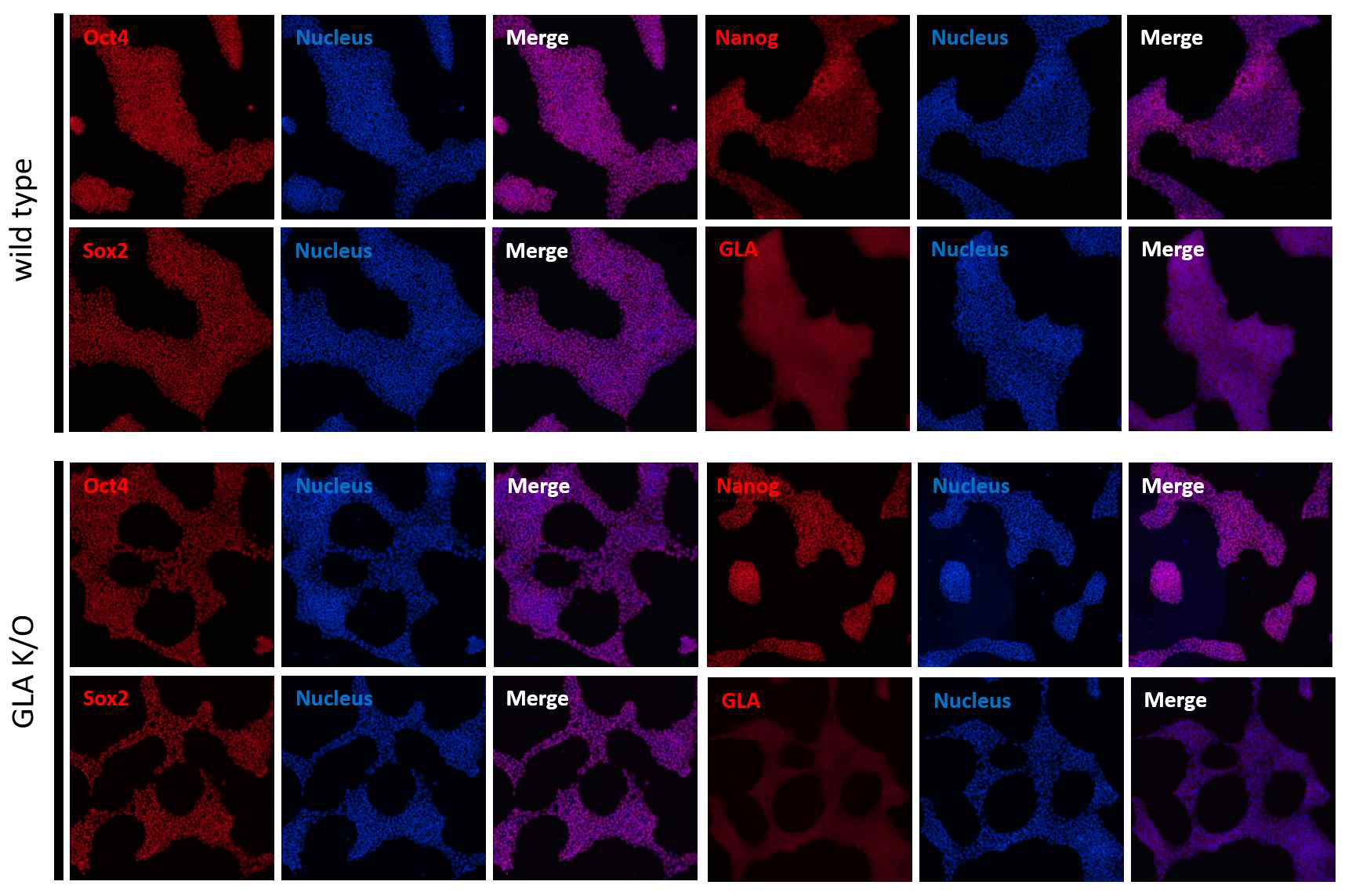 GLA Knock-out human embryonic stem cell line의 Chracterization (위) wild type hESC (아래) GLA Knock-out hESC