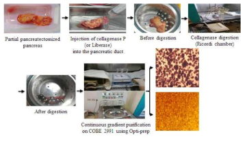 인체췌장조직으로부터 췌도세포 분리 방법