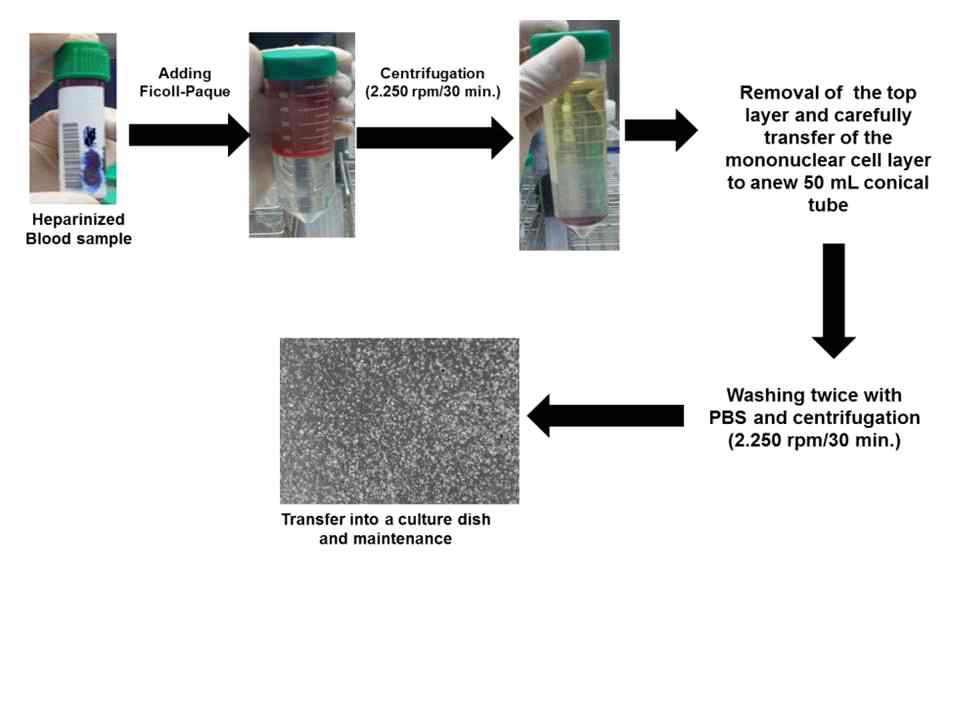 인체 혈액에서 추출한 말초혈액 단핵구 분리