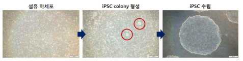 섬유아세포 및 췌도세포에서 유도만능줄기세포 유도 과정