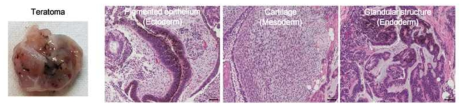 생체내 형성된 teratoma의 조직학적 형태