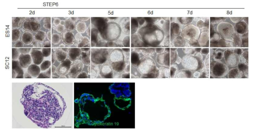 분화과정에서 형성되는 cyst formation