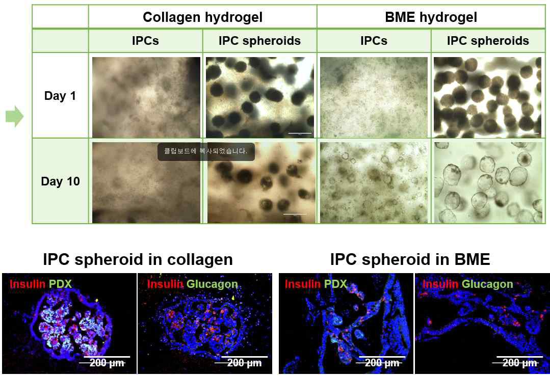 인슐린 생성세포/3차원 스페로이드를 수화젤에 봉입 후 형태 변화 및 인슈린/글루카곤 발현 확인