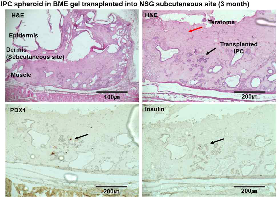 BME 수화젤에 봉입된 인슐린 생성세포 의 피하 이식 후 조직학적 평가 (HE, Insulin, PDX1 염색)