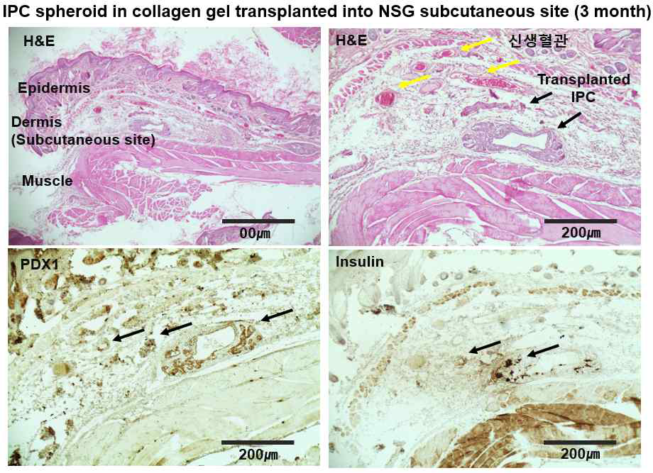 콜라겐 수화젤에 봉입된 인슐린 생성세포 의 피하 이식 후 조직학적 평가 (HE, Insulin, PDX1 염색)