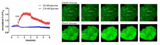 인체 췌도세포에서의 글쿠코즈 농도에 의한 칼슘 이미징