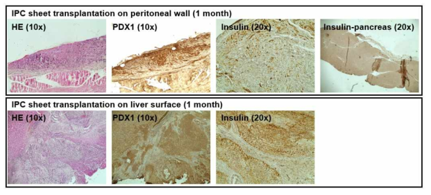 인슐린 생성세포 시트의 간표면 및 복막 이식 후 조직학적 평가