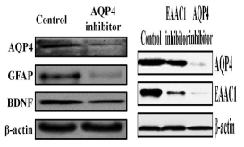 AQP4, EAAC1, GFAP, BDNF expression on AQP4 inhibitor or EAAC1 inhibitor in C6 cells