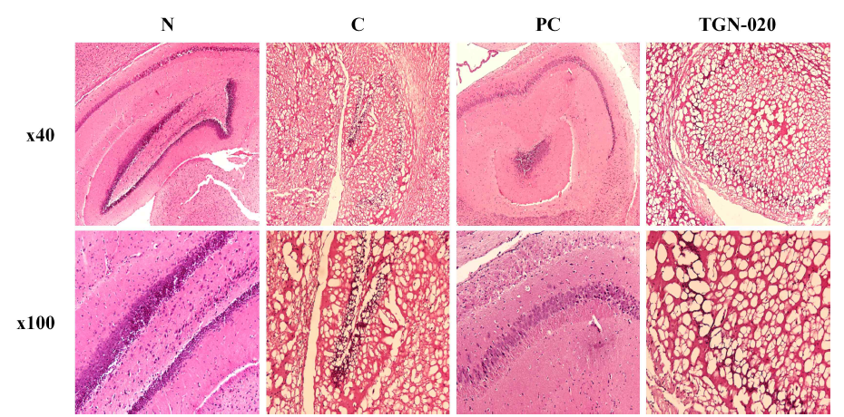 Histological analysis of brain tissue in scopolamine-induced memory impairment in Balb/cJ mice depending on AQP4 inhibition. Brain tissue sections strained with H&E staining. Histological changes were observed at x40(upper panels) and x100(lower panels). N: normal, C: control, PC: donepezil(5 mg/kg), TGN-020(200 mg/kg)
