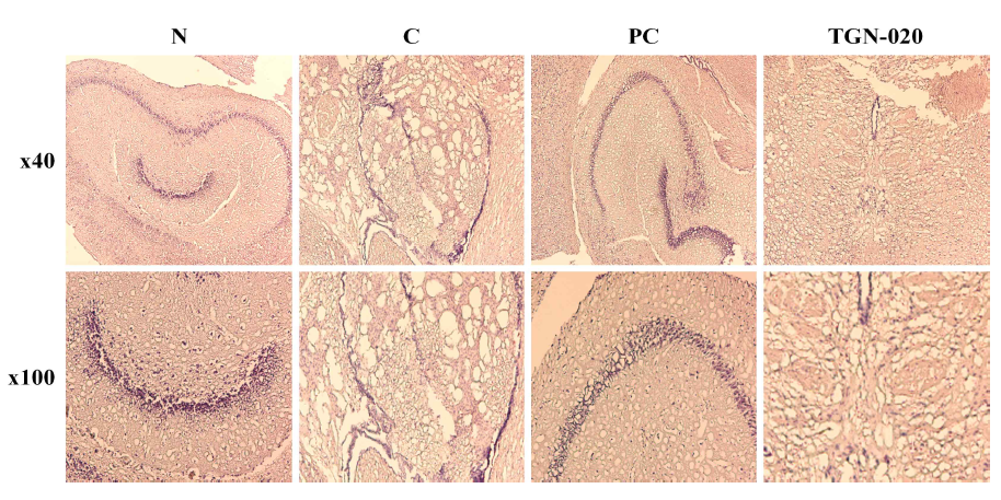 The Aβ1-42 peptide accumulation on scopolamine-induced memory impairment in Balb/cJ mice depending on AQP4 inhibition. Brain tissue sections strained with Congo Red staining. Aβ1-42 peptide accumulation changes were observed at x40(upper panels) and x100(lower panels). N: normal, C: control, PC: donepezil (5 mg/kg), TGN-020 (200 mg/kg)