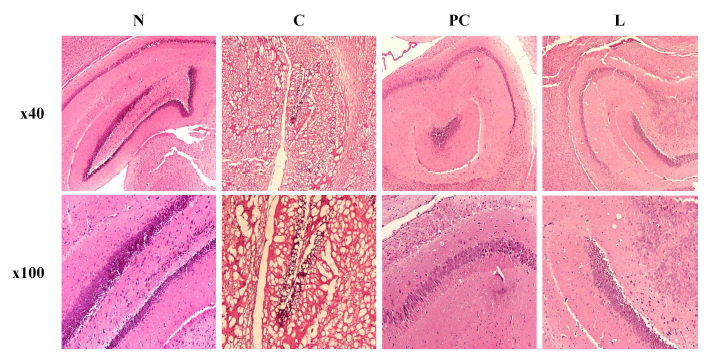 Histological analysis of L-theanine in scopolamine-induced memory impairment in Balb/cJ mice. Brain tissue sections strained with H&E staining. Histological changes were observed at x40(upper panels) and x100(lower panels). N: normal, C: control, PC: donepezil (5 mg/kg), L: L-theanine (4 mg/kg)