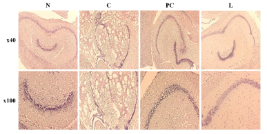 The inhibition of Aβ1-42 peptide accumulation of L-theanine in scopolamine-induced memory impairment in Balb/cJ mice. Brain tissue sections strained with Congo Red staining. Aβ1-42 peptide accumulation changes were observed at x40(upper panels) and x100(lower panels). N: normal, C: control, PC: donepezil (5 mg/kg), L: L-theanine (4 mg/kg)