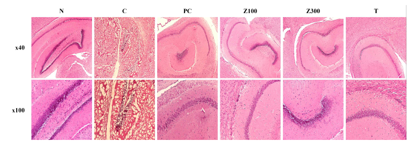 Histological analysis of Z. latifolia ethanol extract or tricin on scopolamine-induced memory impairment in Balb/cJ mice. Brain tissue sections strained with H&E staining. Histological changes were observed at x40(upper panels) and x100(lower panels). N: normal, C: control, PC: donepezil(5 mg/kg), Z100: Z. latifolia ethanol extract(100 mg/kg), Z300: Z. latifolia ethanol extract(300 mg/kg), T: tricin(0.3 mg/kg)