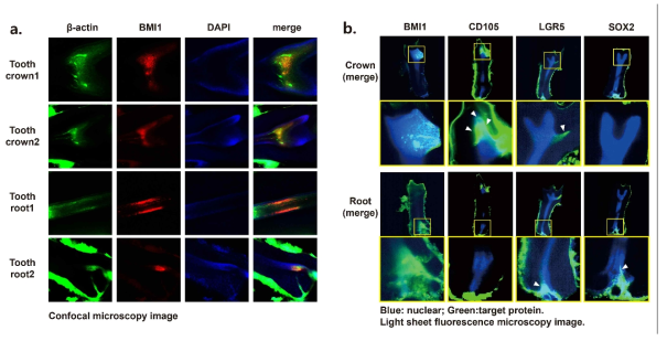 쥐의 어금니 투명화, 항체염색 진행 후 confocal microscope과 LSFM 이미징 결과