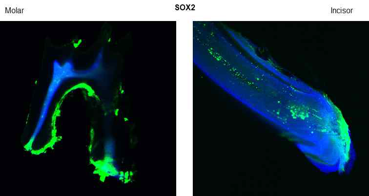 쥐의 어금니(좌)와 앞니(우)에서 치수 내 Sox2 발현이 높은 세포군 이미징