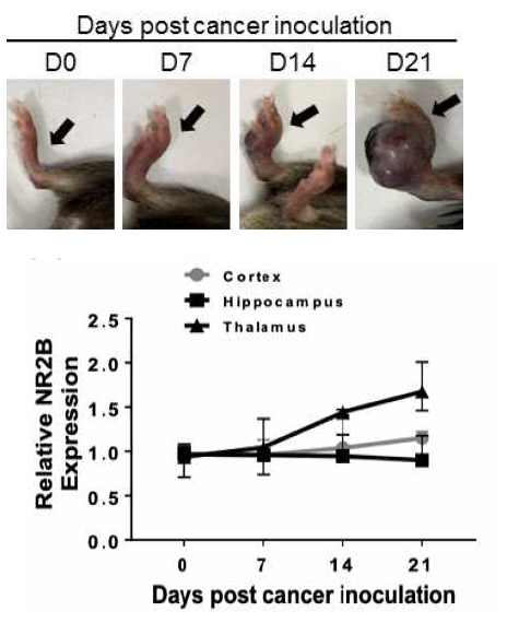 동물모델의 오른쪽 발에 Melanoma 종양을 이식하여 종양을 형성하고 통증 유발 후 시간 별 뇌 조직(Cortex, Hippocampus, Thalamus)에서의 NMDA 수용체 발현 변화 측정 (q-PCR). 암유발에 의하여 Thalamus에서 NMDA 수용체의 유전자 발현이 증가함을 확인함