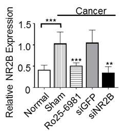 Downregulation of NR2B expression in the thalamus by intranasally delivered RVG9RC/siNR2B nanocomplexes. ***p<0.001 and n.s.-not significant versus Mock group. All data were shown as mean SD. As a positive control, Ro 25-6981 maleate which is a potent and selective activity-dependent blocker of NMDA receptors containing the NR2B is used