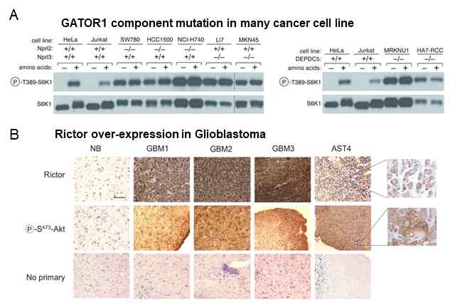 GATOR1 component 돌연변이와 Glioblastoma에서 Rictor 과발현