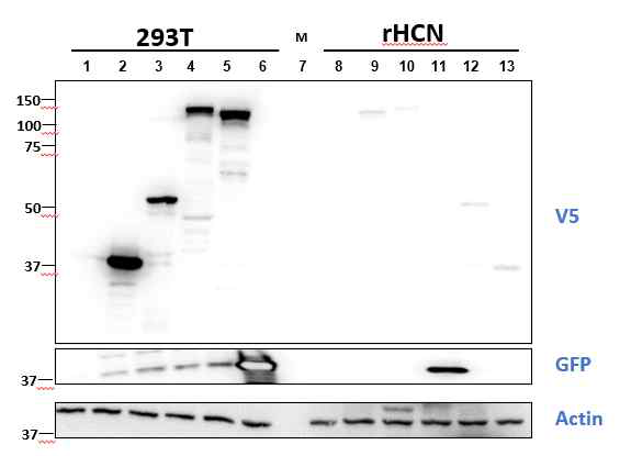 293T와 rHCN에서의 발현 차이