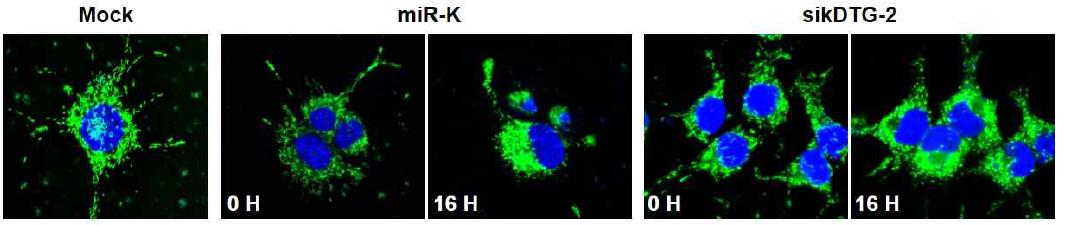 miR-K와 kDTG-2의 발현 조절에 의한 mirochondrial fission 조절